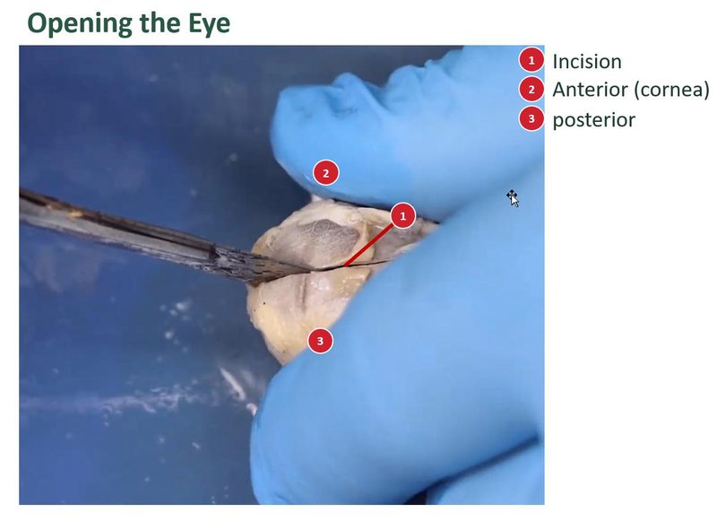 Labeled view of scissors opening a preserved sheep eye. A numbered key marks the incision, the anterior side, and the posterior side.