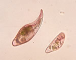 Protists and Fungi