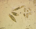 Protists and Fungi