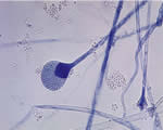 Protists and Fungi