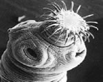 Sponges, Cnidarians and Worms
