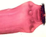 Sponges, Cnidarians and Worms