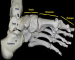 Bones, Muscles and Skin