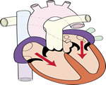 Circulation