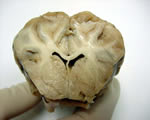 Nervous System
