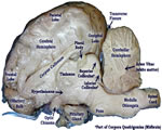 Nervous System