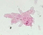 Amoeba specimen photograph from the microscopy collection