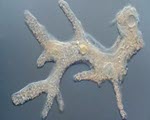 Amoeba specimen photograph from the microscopy collection