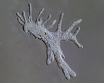 Amoeba specimen photograph from the microscopy collection