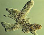 Amoeba specimen photograph from the microscopy collection