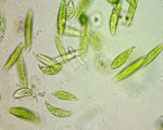 Euglena specimen photograph from the microscopy collection