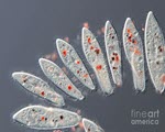 Paramecium specimen photograph from the microscopy collection
