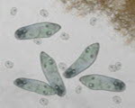 Paramecium specimen photograph from the microscopy collection