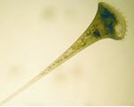 Stentor specimen photograph from the microscopy collection