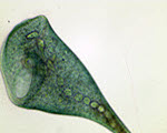 Stentor specimen photograph from the microscopy collection