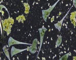 Stentor specimen photograph from the microscopy collection