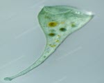 Stentor specimen photograph from the microscopy collection