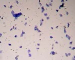 Cheek Cells specimen photograph from the microscopy collection