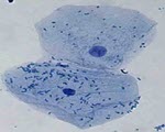 Cheek Cells specimen photograph from the microscopy collection