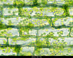 Elodea specimen photograph from the microscopy collection